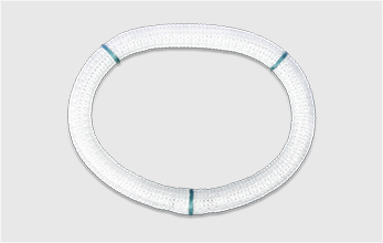 小“环”引领心脏瓣膜病治疗新纪元